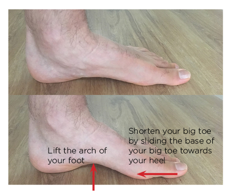 Foot posture and knee pain